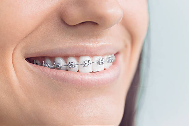Best Veneers and Lumineers  in Brush Prairie, WA